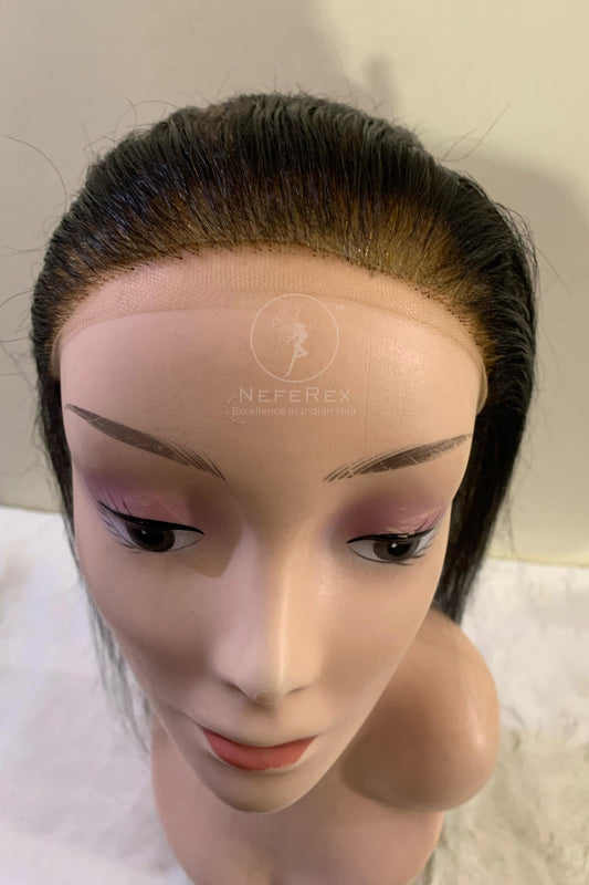 Receding Hairline