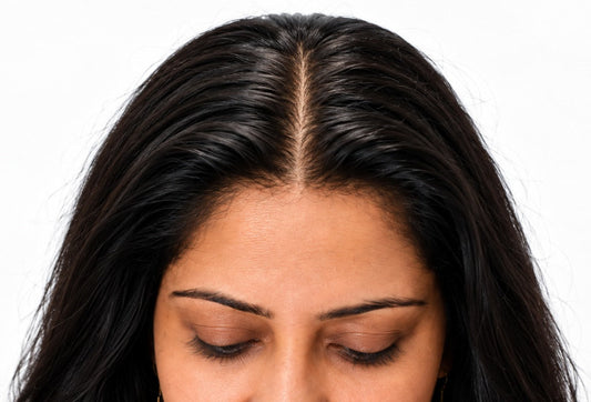 3D Hair Topper vs. Wig: Which One Is Right for You?