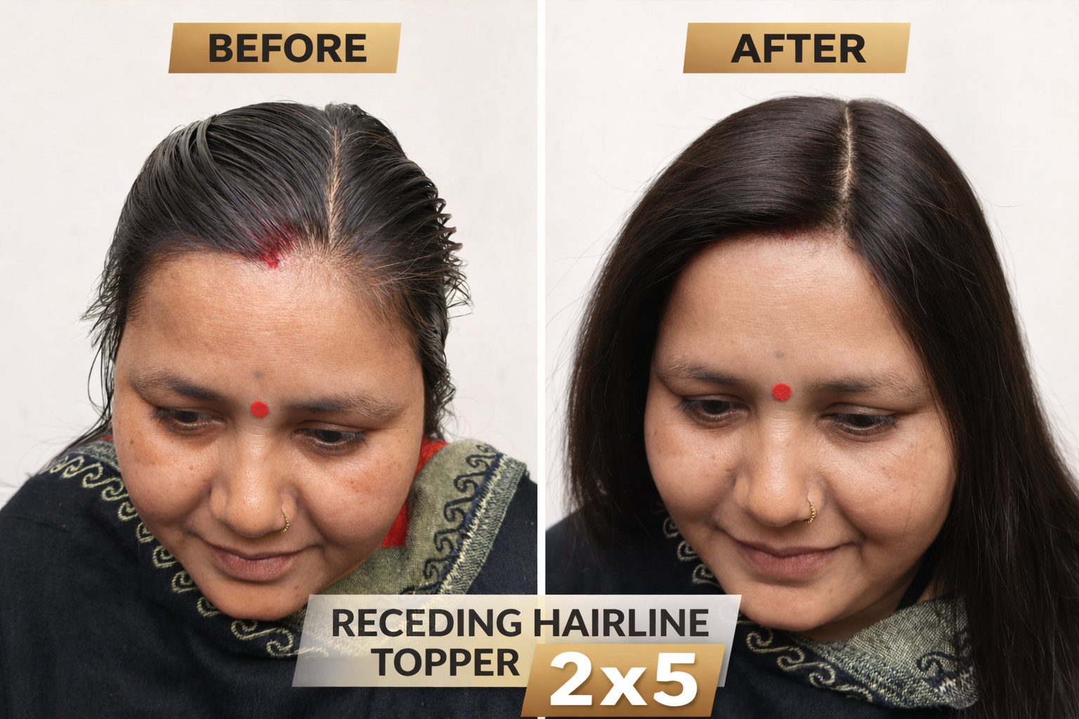 Receding hairline topper (2x5 Base)